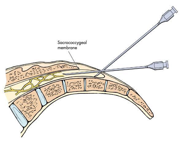 ‘MK电竞’唐河县泗洲第二幼儿园党员干部捐款援疫区